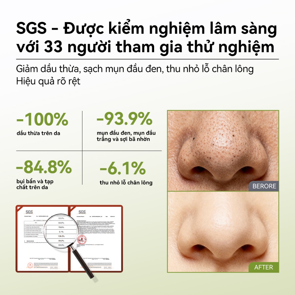Mặt Nạ Lột Mụn Lanbena Loại Bỏ Mụn Đầu Đen Cải Thiện Vấn ... (4)