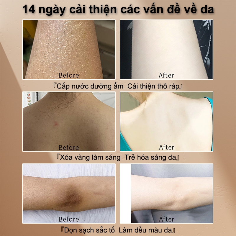 Sữa tắm dê sữa tắm trắng da sữa tắm tẩy ... (5)