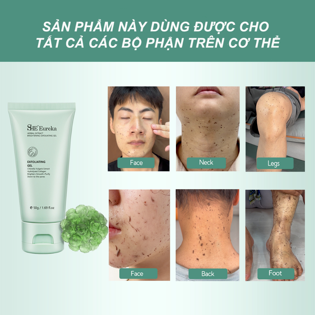 3PC 75.000₫ SHEEureka Chlorella Exfoliating Tẩy Tế Bào Ch... (6)