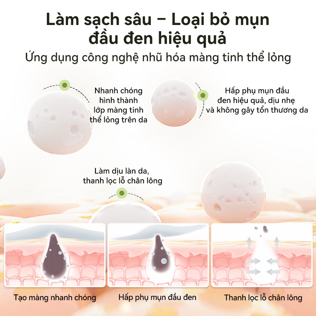 Mặt Nạ Lột Mụn Lanbena Loại Bỏ Mụn Đầu Đen Cải Thiện Vấn ... (6)