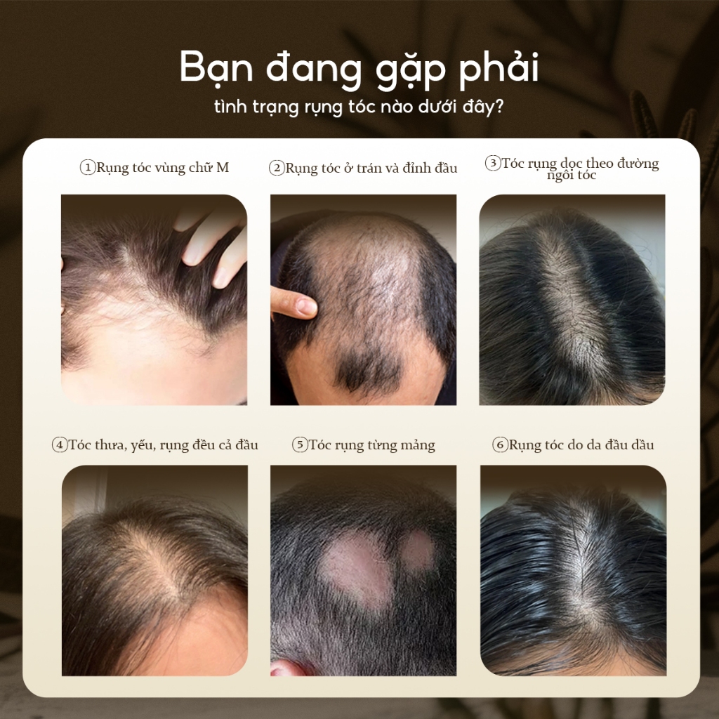 X�t m�c tóc Lab on Hair  x�t dưỡng tóc v�i giấm táo Kích ... (2)