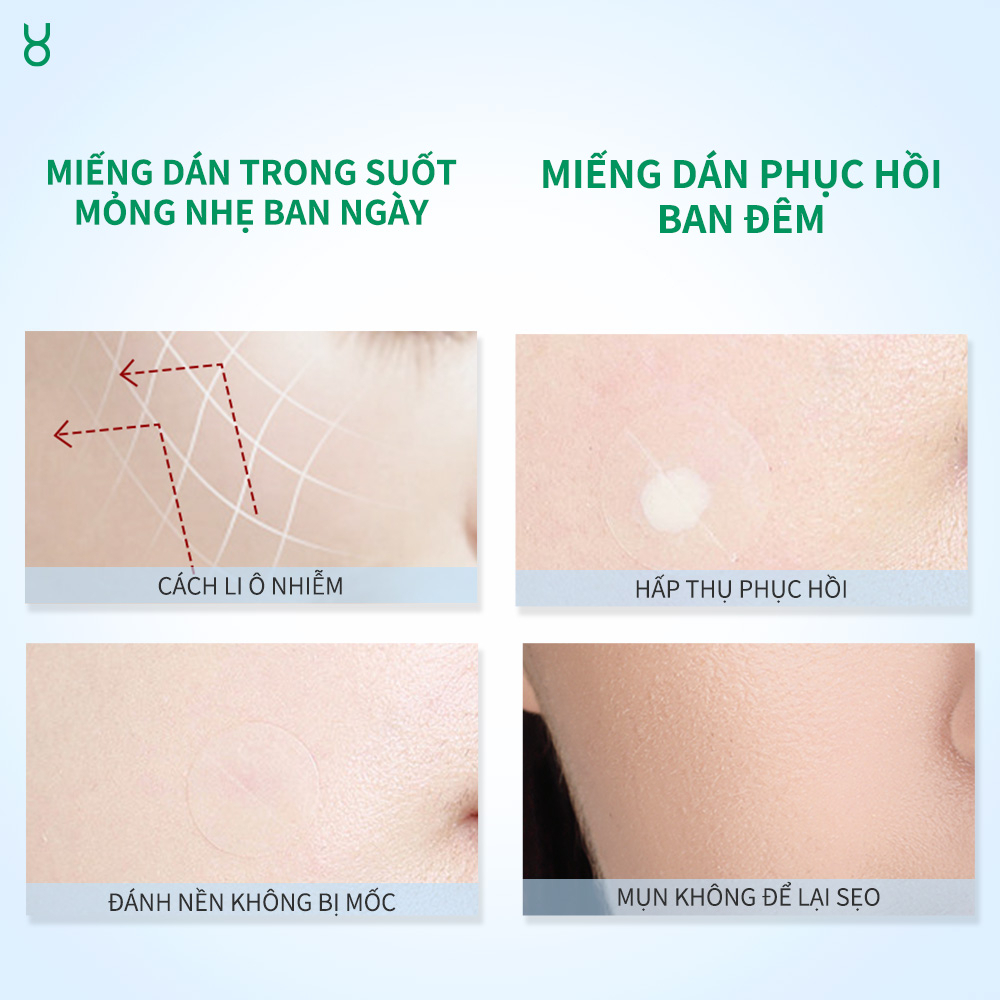 Miếng Dán Mụn BHA FOCALSKIN Siêu M�ng 0.01cm Hút Mụn Sạch... (3)