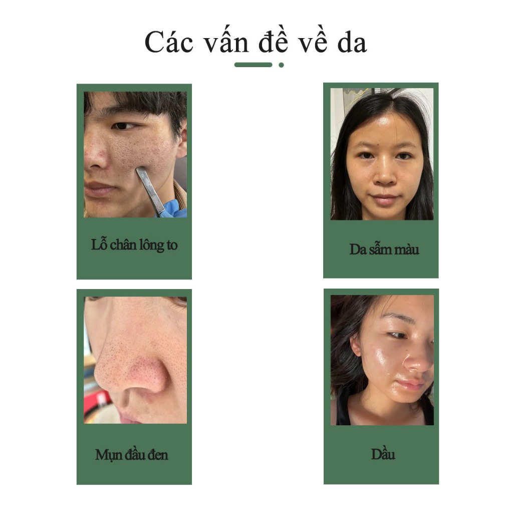 SHEEureka Chlorella Vulgaris Scrub Cleanser Kiểm soát dầu... (4)