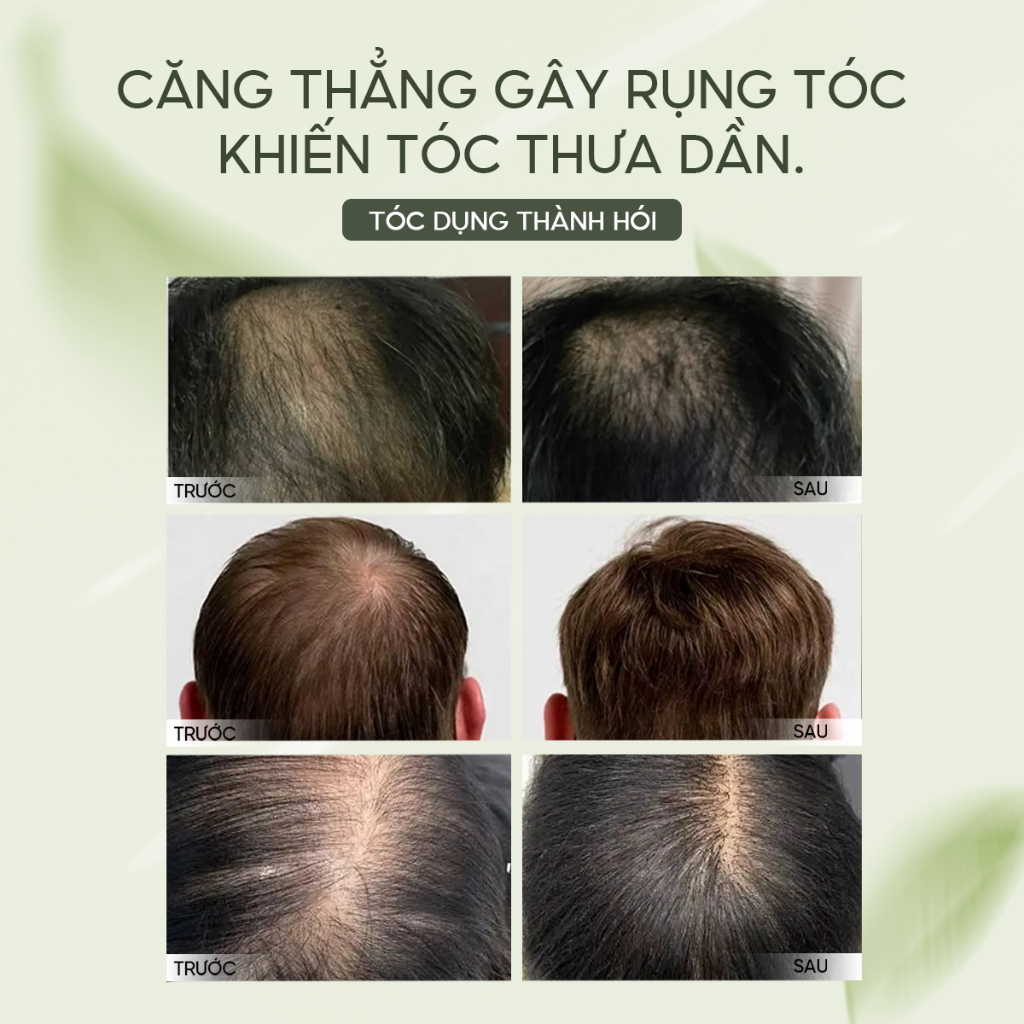 X�t m�c tóc Lab on Hair  x�t dưỡng tóc v�i giấm táo Kích ... (6)